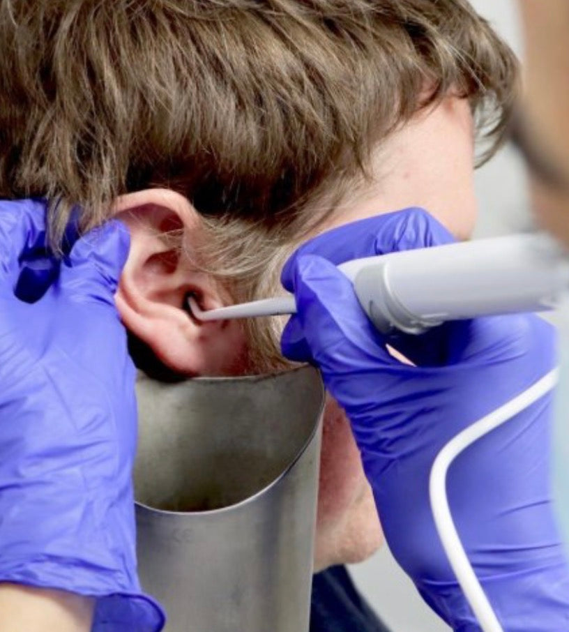 Earwax removal using irrigation (both ears)